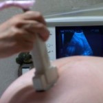 Ultrazvukové vyšetrenia plodu odhalia viac, ako by ste čakali! 