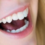 Parodontitída – bez vyčistenia zubov ani na krok